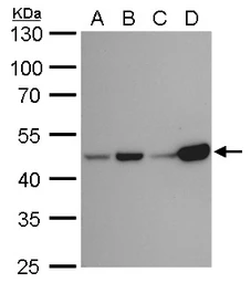 Anti-IDH1 antibody [GT1521] used in Western Blot (WB). GTX629818