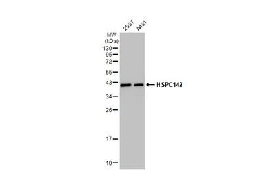 Anti-HSPC142 antibody [GT2810] used in Western Blot (WB). GTX629878