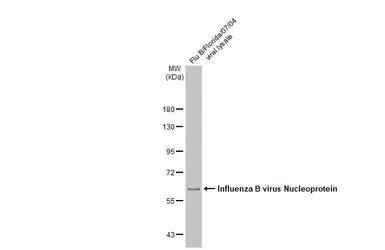 Anti-Influenza B virus Nucleoprotein antibody [GT371] used in Western Blot (WB). GTX629882
