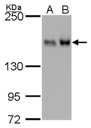 Anti-ROCK1 + ROCK2 antibody [GT261] used in Western Blot (WB). GTX629971