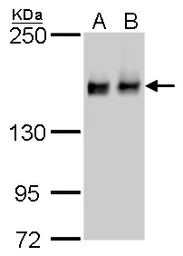 Anti-ROCK1 + ROCK2 antibody [GT464] used in Western Blot (WB). GTX629972