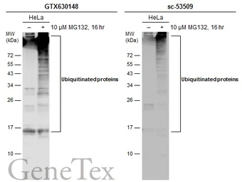 Anti-Ubiquitin antibody [GT7811] used in Western Blot (WB). GTX630148