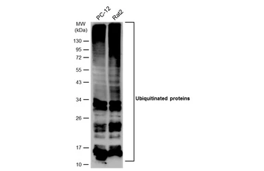 Anti-Ubiquitin antibody [GT7811] used in Western Blot (WB). GTX630148