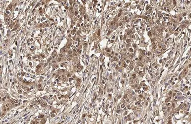 Anti-Ubiquitin antibody [GT7811] used in IHC (Paraffin sections) (IHC-P). GTX630148