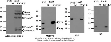 Anti-Enterovirus 71 3C antibody [B3] used in Western Blot (WB). GTX630191