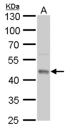 Anti-UQCRC1 antibody [GT1311] used in Western Blot (WB). GTX630393