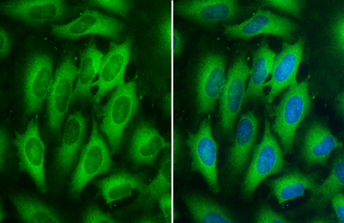 Anti-MEK1 + MEK2 antibody [GT1721] used in Immunocytochemistry/ Immunofluorescence (ICC/IF). GTX630542