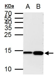 Anti-Histone H3K9ac (Acetyl Lys9) antibody [GT464] used in Western Blot (WB). GTX630554