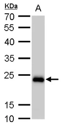 Anti-SOD2 antibody [GT582] used in Western Blot (WB). GTX630558