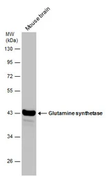 Anti-Glutamine synthetase antibody [GT1055] used in Western Blot (WB). GTX630654
