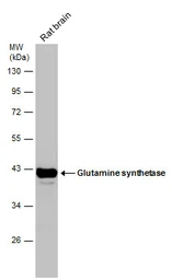Anti-Glutamine synthetase antibody [GT1055] used in Western Blot (WB). GTX630654