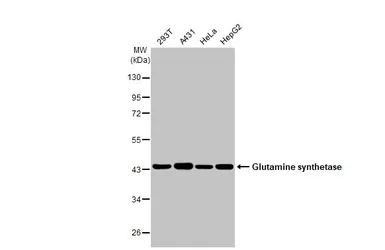 Anti-Glutamine synthetase antibody [GT7711] used in Western Blot (WB). GTX630657