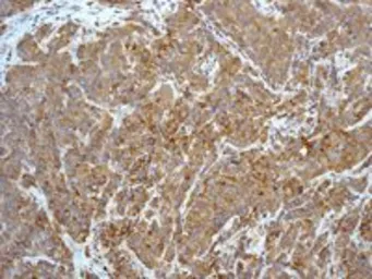 Anti-Caspase 8 antibody [EPR162] used in IHC (Paraffin sections) (IHC-P). GTX63075