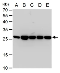 Anti-Triosephosphate isomerase antibody [GT181] used in Western Blot (WB). GTX630779
