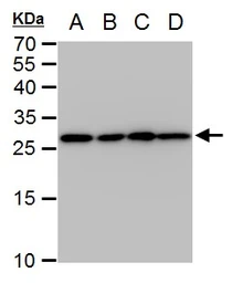 Anti-Triosephosphate isomerase antibody [GT181] used in Western Blot (WB). GTX630779