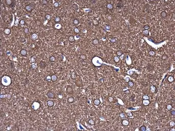 Anti-beta Tubulin 3/ Tuj1 antibody [GT886] used in IHC (Paraffin sections) (IHC-P). GTX631830