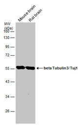 Anti-beta Tubulin 3/ Tuj1 antibody [GT11710] used in Western Blot (WB). GTX631836