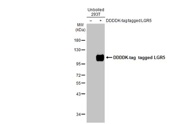Anti-LGR5 antibody [GT11312] used in Western Blot (WB). GTX631935