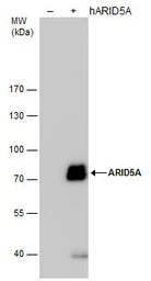 Anti-ARID5A antibody [GT921] used in Western Blot (WB). GTX631938
