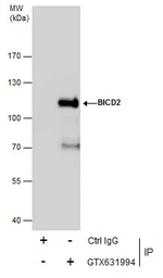 Anti-BICD2 antibody [GT10811] used in Immunoprecipitation (IP). GTX631994