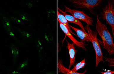 Anti-BICD2 antibody [GT10811] used in Immunocytochemistry/ Immunofluorescence (ICC/IF). GTX631994