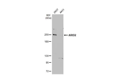 Anti-ARID2 antibody [GT7311] used in Western Blot (WB). GTX632011