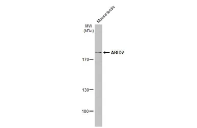Anti-ARID2 antibody [GT7311] used in Western Blot (WB). GTX632011