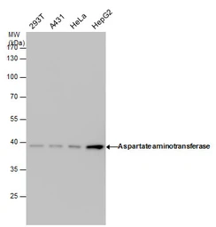 Anti-GOT1 antibody [GT638] used in Western Blot (WB). GTX632031