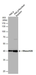 Anti-RNaseH2B antibody [GT673] used in Western Blot (WB). GTX632104