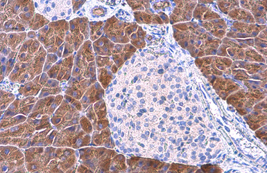 Anti-Pancreatic Lipase antibody [GT1777] used in IHC (Paraffin sections) (IHC-P). GTX632267