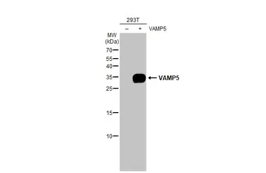 Anti-VAMP5 antibody [3E5] used in Western Blot (WB). GTX632270
