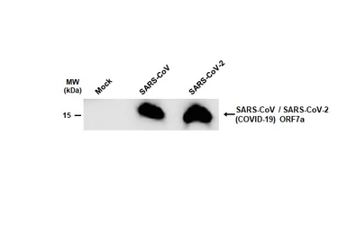 Anti-SARS-CoV / SARS-CoV-2 (COVID-19) ORF7a antibody [3C9] used in Western Blot (WB). GTX632602