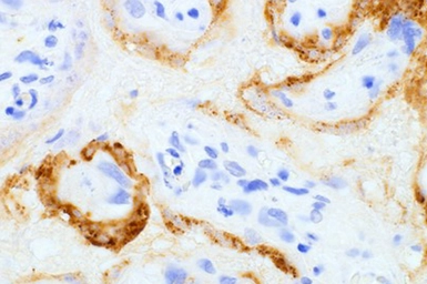 Anti-SARS-CoV / SARS-CoV-2 (COVID-19) spike antibody [1A9] used in IHC (Paraffin sections) (IHC-P). GTX632604