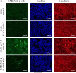 Anti-SARS-CoV / SARS-CoV-2 (COVID-19) spike antibody [1A9] used in Immunocytochemistry/ Immunofluorescence (ICC/IF). GTX632604
