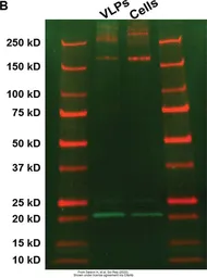 Anti-SARS-CoV / SARS-CoV-2 (COVID-19) spike antibody [1A9] used in Western Blot (WB). GTX632604