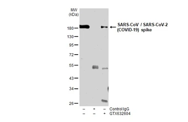 Anti-SARS-CoV / SARS-CoV-2 (COVID-19) spike antibody [1A9] used in Immunoprecipitation (IP). GTX632604