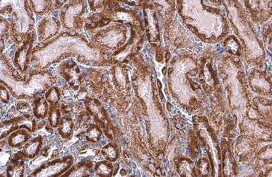 Anti-SDHA antibody [GT20710] used in IHC (Paraffin sections) (IHC-P). GTX632636