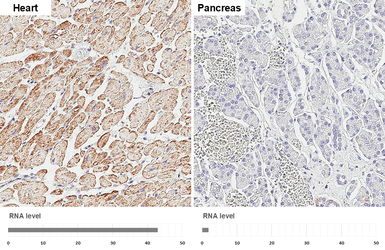 Anti-SDHA antibody [GT20710] used in IHC (Paraffin sections) (IHC-P). GTX632636