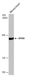 Anti-MYH6 antibody [GT5612] used in Western Blot (WB). GTX632649