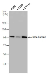 Anti-beta Catenin antibody [GT3171] used in Western Blot (WB). GTX632676