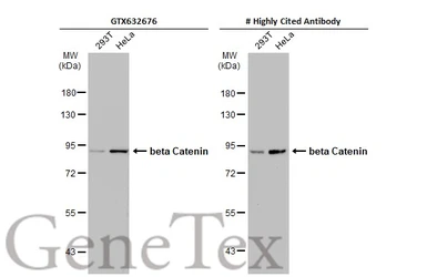 Anti-beta Catenin antibody [GT3171] used in Western Blot (WB). GTX632676