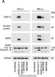 Anti-SARS-CoV / SARS-CoV-2 (COVID-19) nsp8 antibody [5A10] used in Western Blot (WB). GTX632696
