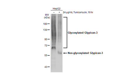 Anti-Glypican-3 antibody [GT2473] used in Western Blot (WB). GTX633410