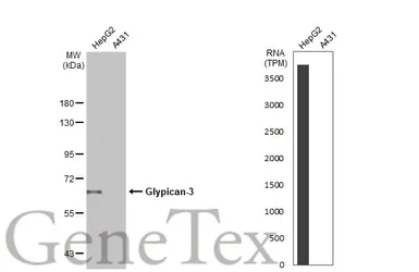 Anti-Glypican-3 antibody [GT2473] used in Western Blot (WB). GTX633410