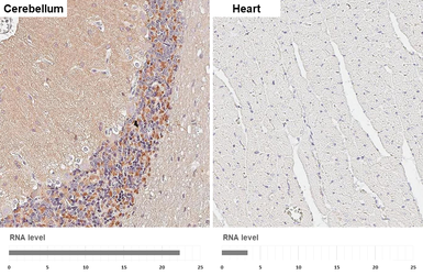Anti-ATP6V1A antibody [GT3846] used in IHC (Paraffin sections) (IHC-P). GTX633542
