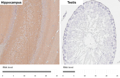 Anti-ATP6V1A antibody [GT3846] used in IHC (Paraffin sections) (IHC-P). GTX633542