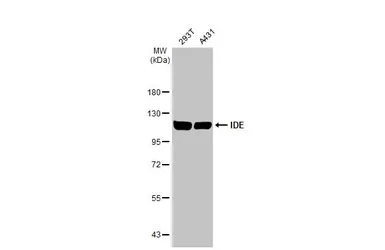 Anti-IDE antibody [GT286] used in Western Blot (WB). GTX633625