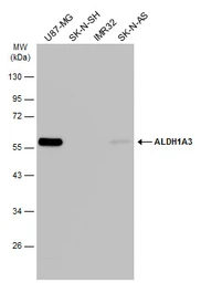 Anti-ALDH1A3 antibody [GT926] used in Western Blot (WB). GTX633822