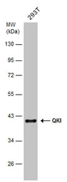 Anti-QKI antibody [GT1589] used in Western Blot (WB). GTX633920