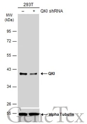 Anti-QKI antibody [GT2612] used in Western Blot (WB). GTX633921